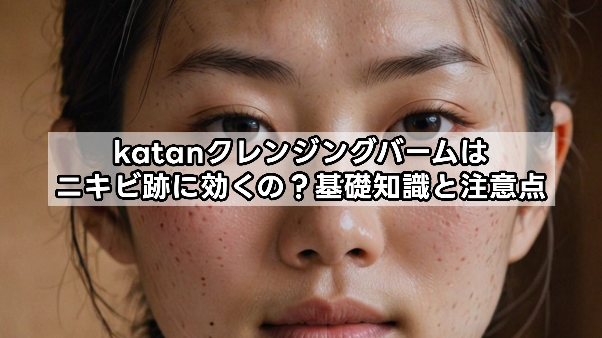 katanクレンジングバームはニキビ跡に効くの？基礎知識と注意点