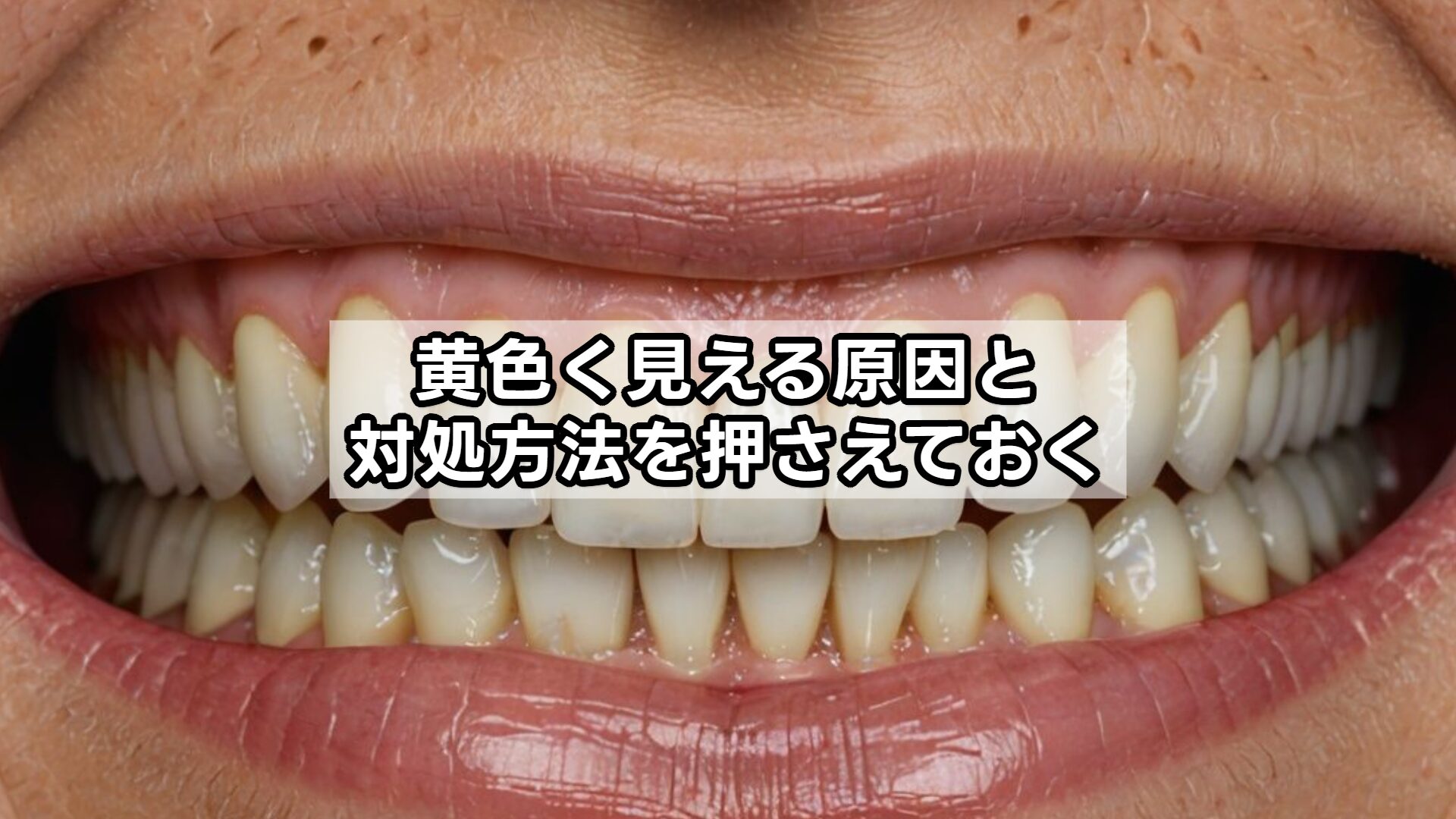 黄色く見える原因と対処方法を押さえておく