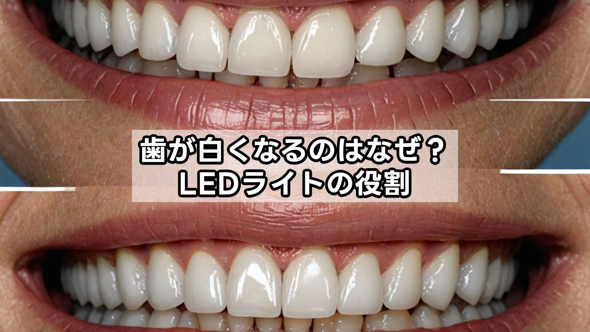 歯が白くなるのはなぜ？LEDライトの役割