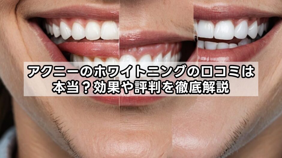 アクニーのホワイトニングの口コミは本当？効果や評判を徹底解説